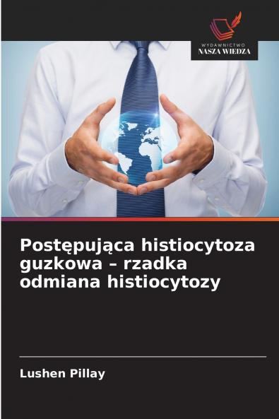 Postępująca histiocytoza guzkowa - rzadka odmiana histiocytozy