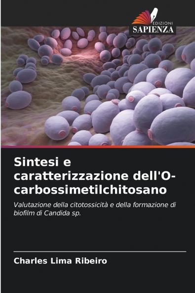 Sintesi e caratterizzazione dell'O-carbossimetilchitosano