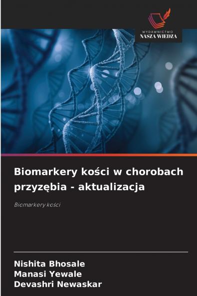 Biomarkery kości w chorobach przyzębia - aktualizacja