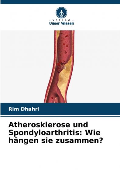 Atherosklerose und Spondyloarthritis