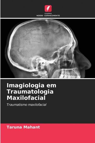 Imagiologia em Traumatologia Maxilofacial