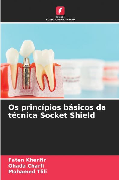 Os princípios básicos da técnica Socket Shield