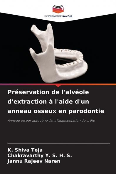 Préservation de l'alvéole d'extraction à l'aide d'un anneau osseux en parodontie