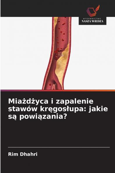 Miażdżyca i zapalenie stawów kręgosłupa