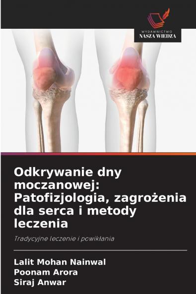 Odkrywanie dny moczanowej