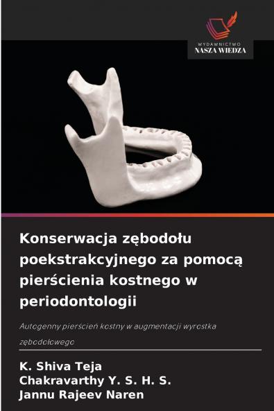 Konserwacja zębodołu poekstrakcyjnego za pomocą pierścienia kostnego w periodontologii