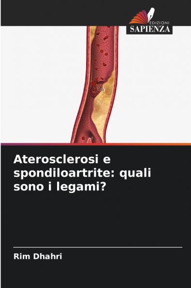 Aterosclerosi e spondiloartrite