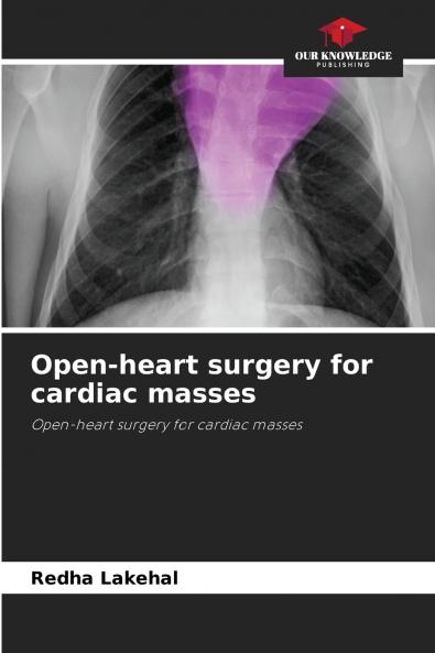 Open-heart surgery for cardiac masses