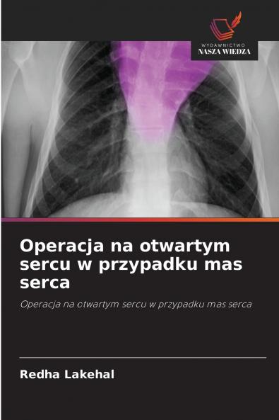 Operacja na otwartym sercu w przypadku mas serca