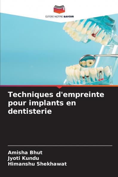 Techniques d'empreinte pour implants en dentisterie
