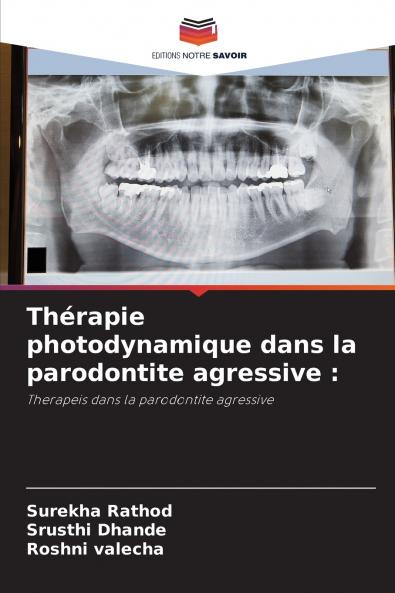 Thérapie photodynamique dans la parodontite agressive