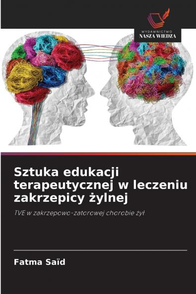 Sztuka edukacji terapeutycznej w leczeniu zakrzepicy żylnej