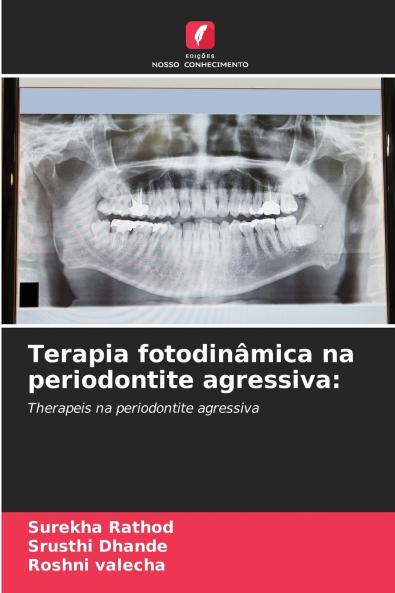 Terapia fotodinâmica na periodontite agressiva