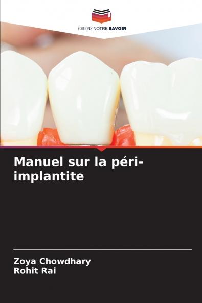 Manuel sur la péri-implantite