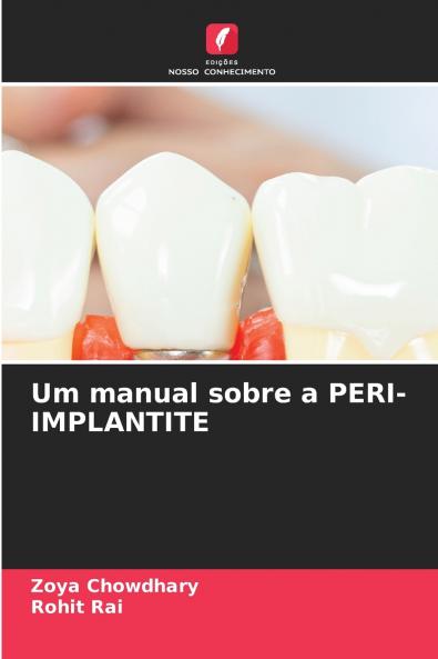 Um manual sobre a PERI-IMPLANTITE