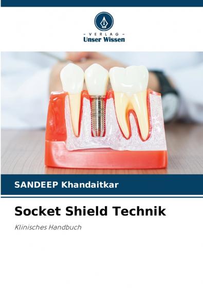 Socket Shield Technik