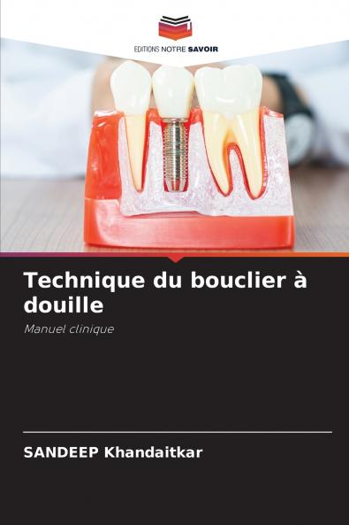 Technique du bouclier à douille