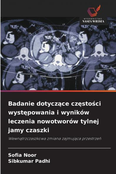 Badanie dotyczące częstości występowania i wyników leczenia nowotworów tylnej jamy czaszki