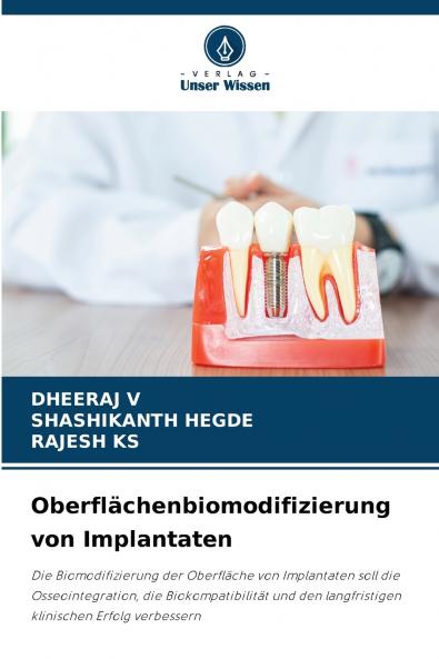 Oberflächenbiomodifizierung von Implantaten
