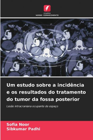 Um estudo sobre a incidência e os resultados do tratamento do tumor da fossa posterior