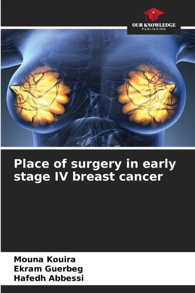 Place of surgery in early stage IV breast cancer