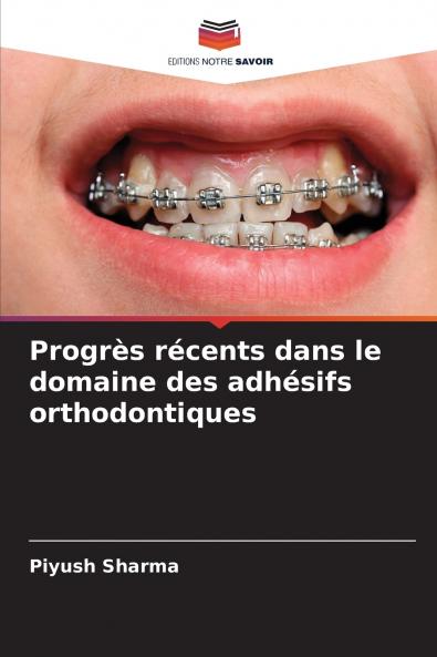 Progrès récents dans le domaine des adhésifs orthodontiques