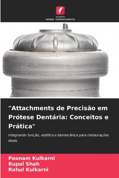 Attachments de Precisão em Prótese Dentária