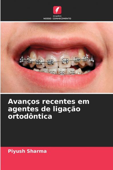 Avanços recentes em agentes de ligação ortodôntica