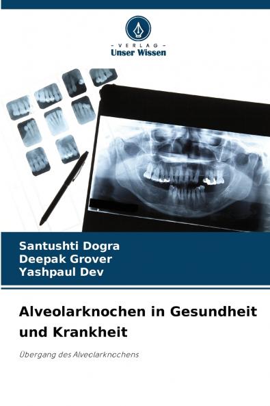 Alveolarknochen in Gesundheit und Krankheit