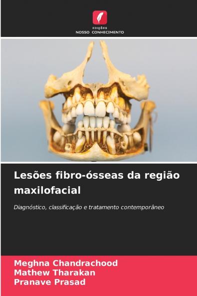 Lesões fibro-ósseas da região maxilofacial