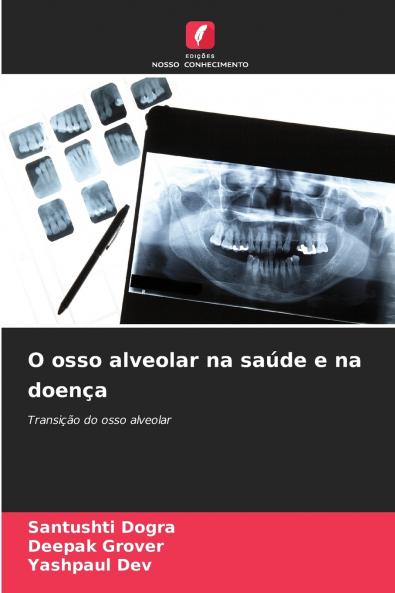 O osso alveolar na saúde e na doença