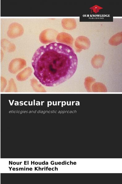 Vascular purpura