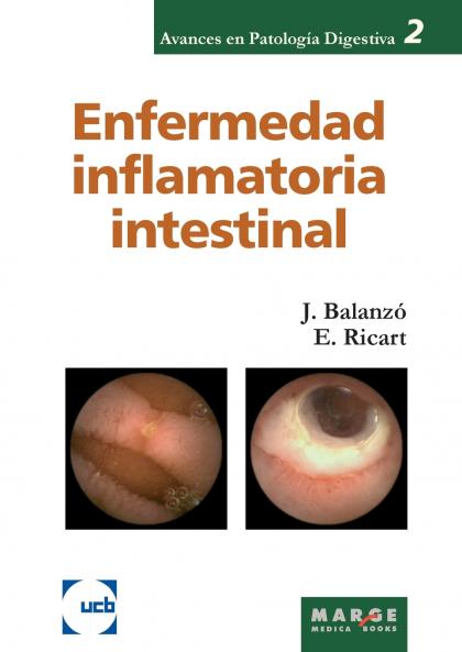 Enfermedad inflamatoria intestinal