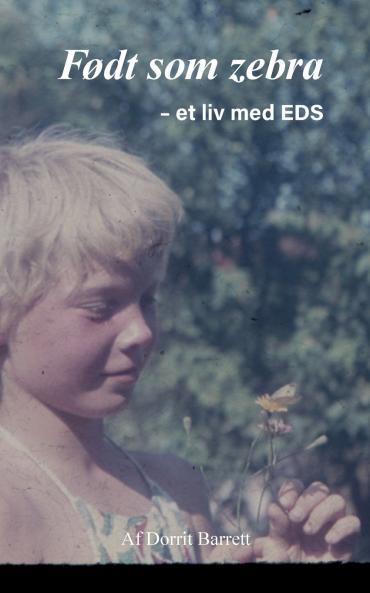 Født som Zebra