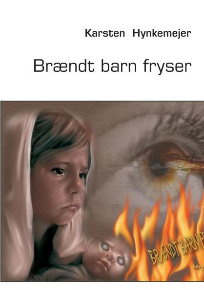 Brændt barn fryser