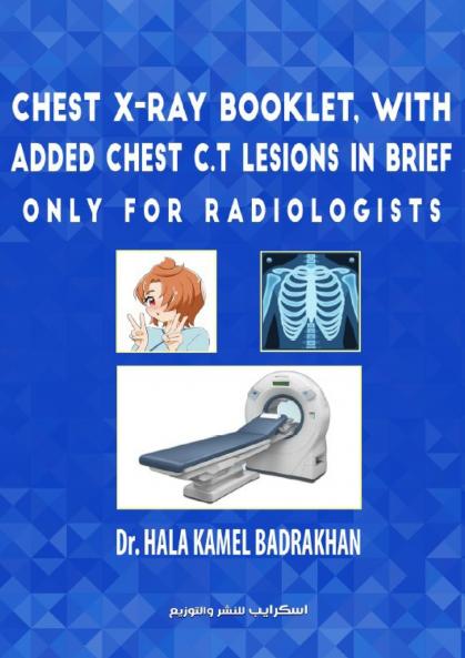 Chest X-Ray Booklet with added Chest C.T Lesions in brief Only for Radiologists