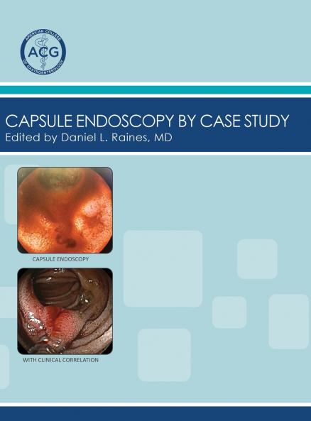 Capsule Endoscopy by Case Study Volume 2