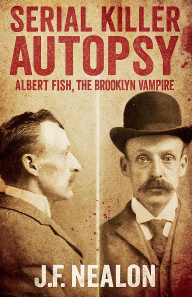 Serial Killer Autopsy