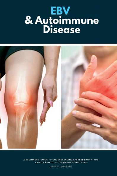 EBV & Autoimmune Disease
