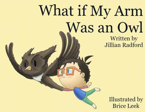 What if my Arm was an Owl?