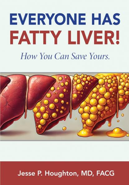 EVERYONE HAS FATTY LIVER!
