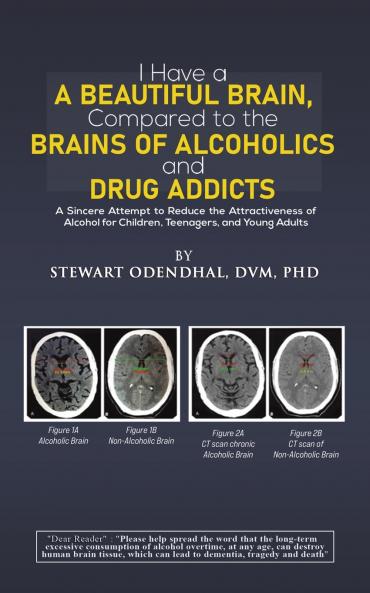 I Have a Beautiful Brain Compared to the Brains of Alcoholics and Drug Addicts