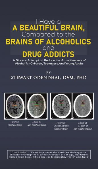 I Have a Beautiful Brain Compared to the Brains of Alcoholics and Drug Addicts