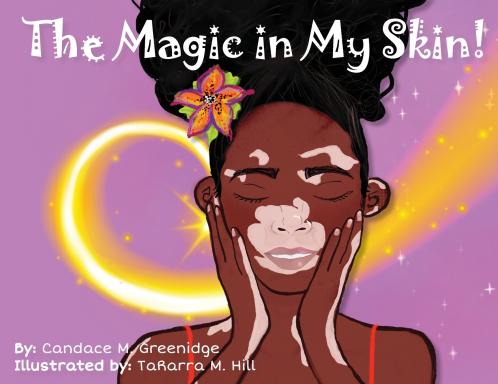 The Magic in My Skin!