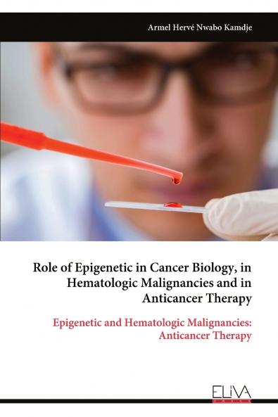 Role of Epigenetic in Cancer Biology in Hematologic Malignancies and in Anticancer Therapy