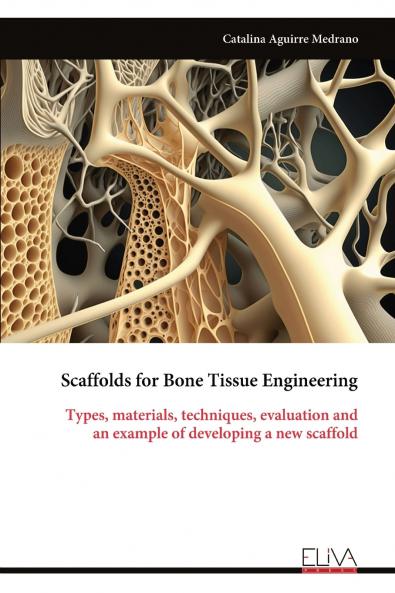 Scaffolds for Bone Tissue Engineering