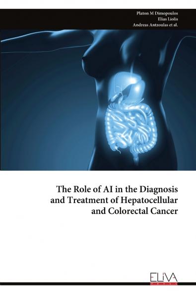 The Role of AI in the Diagnosis and Treatment of Hepatocellular and Colorectal Cancer