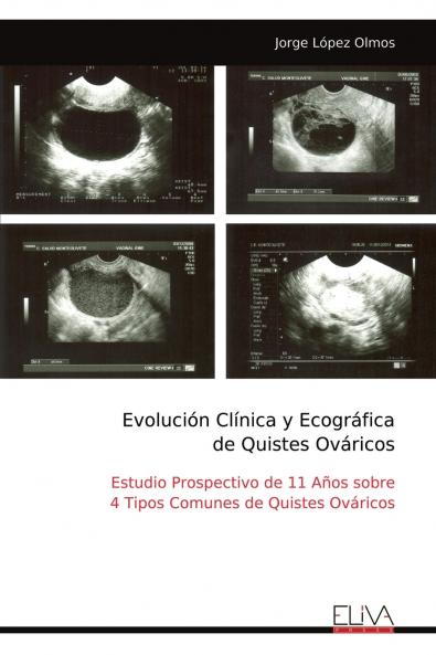 Evolución Clínica y Ecográfica de Quistes Ováricos