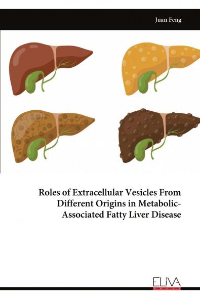 Roles of Extracellular Vesicles From Different Origins in Metabolic- Associated Fatty Liver Disease