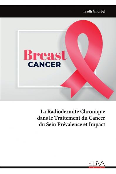 La Radiodermite Chronique dans le Traitement du Cancer du Sein Prévalence et Impact